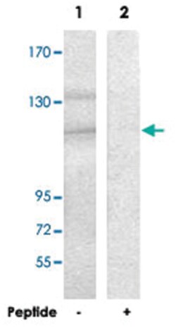 SDCCAG1 Rabbit anti-Human, Mouse, Rat, Polyclonal Antibody, Abnova 100&mu;g;