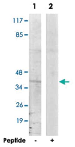 TBX10, Rabbit, Polyclonal Antibody, Abnova 100&mu;g; Unlabeled:Antibodies,