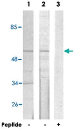 ZNF682, Rabbit, Polyclonal Antibody, Abnova 100 &mu;g | Buy Online | Abnova | Fisher Scientific