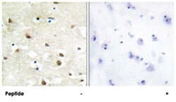 HNRNPC Rabbit anti-Human, Mouse, Rat, Polyclonal Antibody, Abnova 100&mu;g;