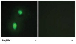 HNRNPC Rabbit anti-Human, Mouse, Rat, Polyclonal Antibody, Abnova 100&mu;g;