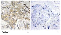 TM4SF1 Rabbit anti-Human, Mouse, Polyclonal Antibody, Abnova 100&mu;g;