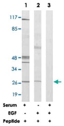 HOXD12, Rabbit, Polyclonal Antibody, Abnova 100&mu;g; Unlabeled:Antibodies,