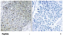 ETV4, Rabbit, Polyclonal Antibody, Abnova 100&mu;g; Unlabeled:Antibodies,
