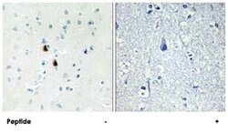 PKIA, Rabbit, Polyclonal Antibody, Abnova 100&mu;g; Unlabeled:Antibodies,