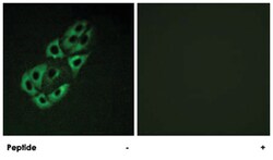 SSBP1, Rabbit, Polyclonal Antibody, Abnova 100&mu;g; Unlabeled:Antibodies,