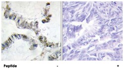 HMGXB3, Rabbit, Polyclonal Antibody, Abnova 100&mu;g; Unlabeled:Antibodies,