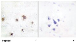 MAPK8IP2, Rabbit, Polyclonal Antibody, Abnova 100&mu;g; Unlabeled:Antibodies,
