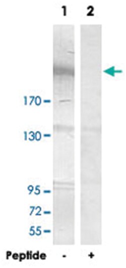 ZNF638 Rabbit anti-Human, Polyclonal Antibody, Abnova 100 &mu;g | Buy Online | Abnova Corporation | Fisher Scientific