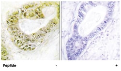 ZNF638 Rabbit anti-Human, Polyclonal Antibody, Abnova 100 &mu;g | Buy Online | Abnova Corporation | Fisher Scientific