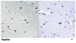 FAM111B, Rabbit, Polyclonal Antibody, Abnova 100&mu;g; Unlabeled:Antibodies,