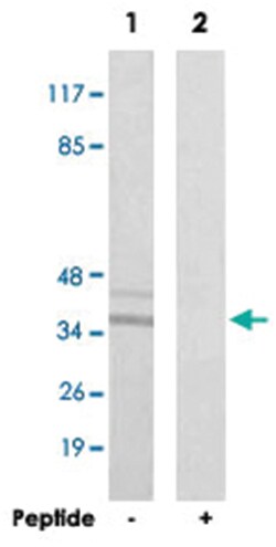 CTU1, Rabbit, Polyclonal Antibody, Abnova 100 &mu;g | Buy Online | Abnova | Fisher Scientific