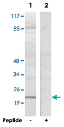 MOBKL2B, Rabbit, Polyclonal Antibody, Abnova 100 &mu;g | Buy Online | Abnova | Fisher Scientific