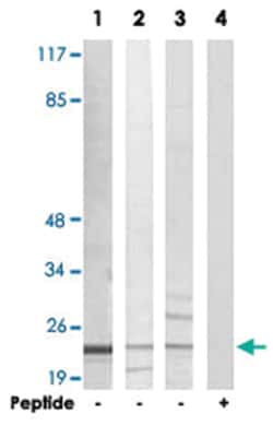 AKAP14, Rabbit, Polyclonal Antibody, Abnova 100&mu;g; Unlabeled:Antibodies,