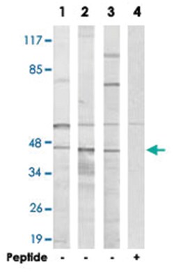 HORMAD1, Rabbit, Polyclonal Antibody, Abnova 100&mu;g; Unlabeled:Antibodies,