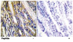 DGKH, Rabbit, Polyclonal Antibody, Abnova 100&mu;g; Unlabeled:Antibodies,