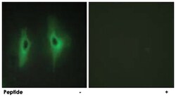 DGKH, Rabbit, Polyclonal Antibody, Abnova 100&mu;g; Unlabeled:Antibodies,