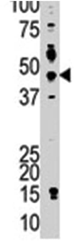 PSMD4 Rabbit anti-Human, Polyclonal Antibody, Abnova 400&mu;L; Unlabeled:Antibodies,