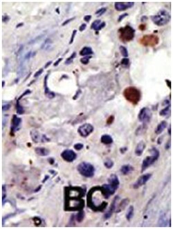 PSMD4 Rabbit anti-Human, Polyclonal Antibody, Abnova 400&mu;L; Unlabeled:Antibodies,