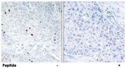 TP53INP2, Rabbit, Polyclonal Antibody, Abnova 100 &mu;g | Buy Online | Abnova Corporation | Fisher Scientific