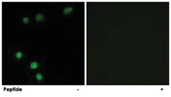 TP53INP2, Rabbit, Polyclonal Antibody, Abnova 100 &mu;g | Buy Online | Abnova Corporation | Fisher Scientific