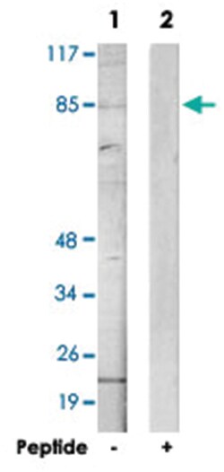 ANKK1 Rabbit anti-Human, Polyclonal Antibody, Abnova 100 &mu;g | Buy Online | Abnova | Fisher Scientific