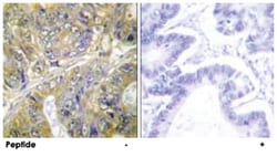 EPS8L3, Rabbit, Polyclonal Antibody, Abnova 100 &mu;g | Buy Online | Abnova Corporation | Fisher Scientific