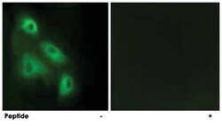 EPS8L3, Rabbit, Polyclonal Antibody, Abnova 100 &mu;g | Buy Online | Abnova Corporation | Fisher Scientific