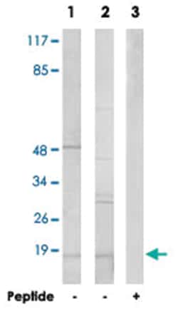 ORAOV1, Rabbit, Polyclonal Antibody, Abnova 100 &mu;g | Buy Online | Abnova | Fisher Scientific