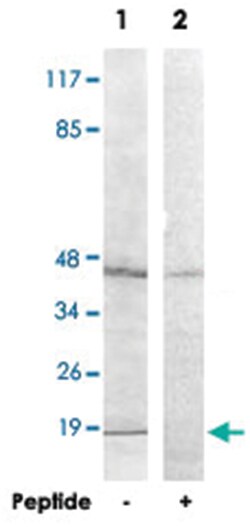 HIST1H2BH Rabbit anti-Human, Mouse, Polyclonal Antibody, Abnova 100 &mu;g | Buy Online | Abnova | Fisher Scientific