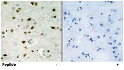 HIST1H2BH Rabbit anti-Human, Mouse, Polyclonal Antibody, Abnova 100 &mu;g | Buy Online | Abnova | Fisher Scientific