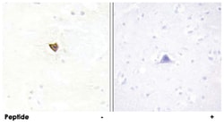 JAKMIP2 Rabbit anti-Human, Polyclonal Antibody, Abnova 100 &mu;g | Buy Online | Abnova | Fisher Scientific