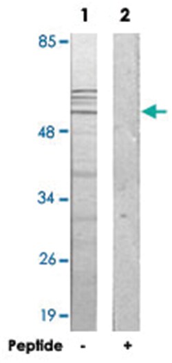 IP6K3, Rabbit, Polyclonal Antibody, Abnova 100 &mu;g | Buy Online | Abnova Corporation | Fisher Scientific