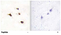 IP6K3, Rabbit, Polyclonal Antibody, Abnova 100 &mu;g | Buy Online | Abnova Corporation | Fisher Scientific