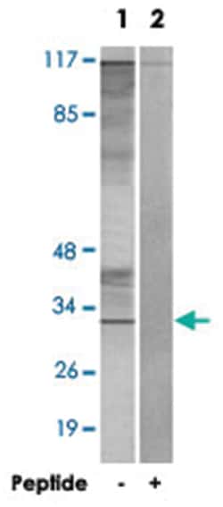 CIB3 Rabbit anti-Human, Mouse, Polyclonal Antibody, Abnova 100&mu;g; Unlabeled:Antibodies,