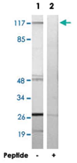 RPS6KC1, Rabbit, Polyclonal Antibody, Abnova 100&mu;g; Unlabeled:Antibodies,