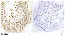 SPZ1 Rabbit anti-Human, Mouse, Rat, Polyclonal Antibody, Abnova 100 &mu;g | Buy Online | Abnova | Fisher Scientific