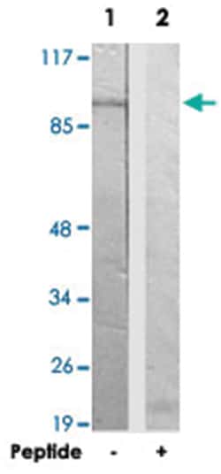 NAA1, Rabbit, Polyclonal Antibody, Abnova 100&mu;g; Unlabeled:Antibodies,