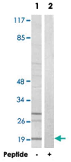 PBOV1, Rabbit, Polyclonal Antibody, Abnova 100&mu;g; Unlabeled:Antibodies,