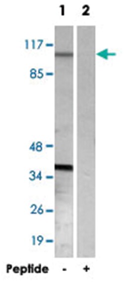 XRN2, Rabbit, Polyclonal Antibody, Abnova 100&mu;g; Unlabeled:Antibodies,