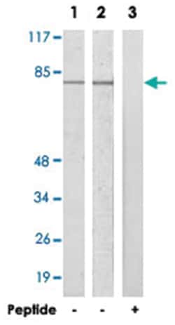ARNT2, Rabbit, Polyclonal Antibody, Abnova 100&mu;g; Unlabeled:Antibodies,