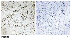 TSHZ2 Rabbit anti-Human, Mouse, Polyclonal Antibody, Abnova 100&mu;g; Unlabeled:Antibodies,