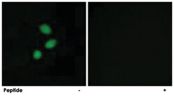 TSHZ2 Rabbit anti-Human, Mouse, Polyclonal Antibody, Abnova 100&mu;g; Unlabeled:Antibodies,