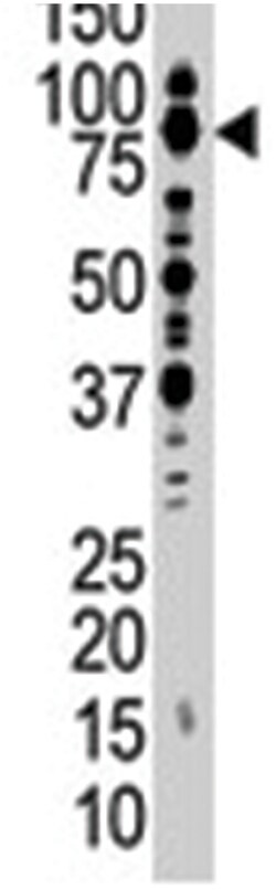 SMURF1 Rabbit anti-Human, Polyclonal Antibody, Abnova 400 &mu;L | Buy Online | Abnova | Fisher Scientific