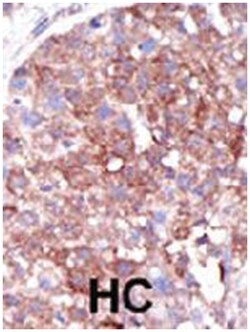 SMURF1 Rabbit anti-Human, Polyclonal Antibody, Abnova 400 &mu;L | Buy Online | Abnova | Fisher Scientific