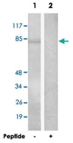 ZNF225, Rabbit, Polyclonal Antibody, Abnova 100 &mu;g | Buy Online | Abnova | Fisher Scientific