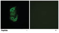 STARD13 Rabbit anti-Human, Mouse, Polyclonal Antibody, Abnova 100&mu;g;