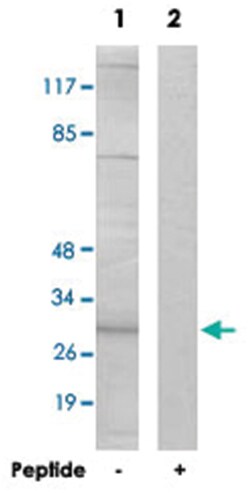 SPIN1, Rabbit, Polyclonal Antibody, Abnova 100 &mu;g | Buy Online | Abnova | Fisher Scientific