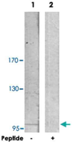 ACTN3, Rabbit, Polyclonal Antibody, Abnova 100&mu;g; Unlabeled:Antibodies,