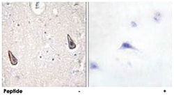ADCY5/ADCY6, Rabbit, Polyclonal Antibody, Abnova 100&mu;g; Unlabeled:Antibodies,